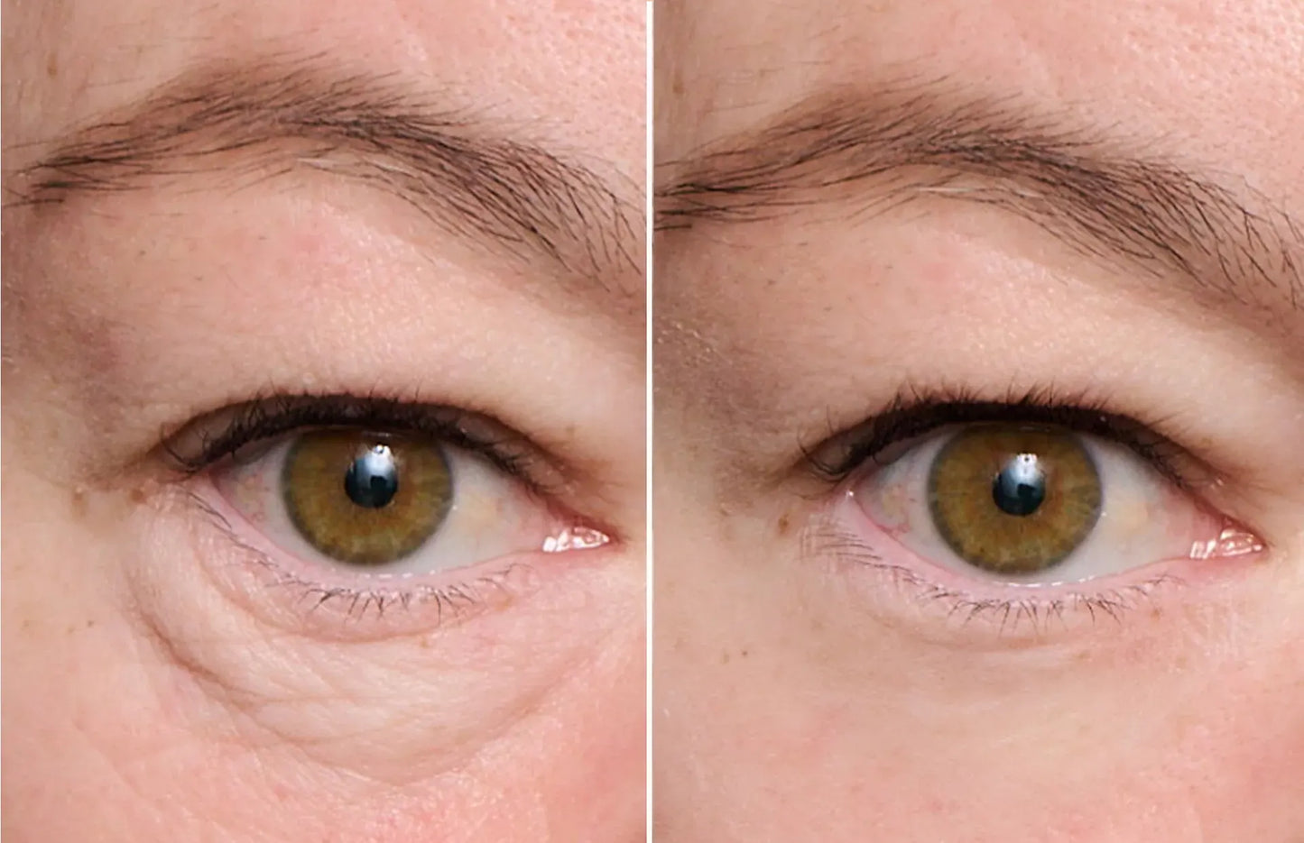 Peter Thomas Roth Instant FirmX Easy Wear Tijdelijke Oogverstrakking