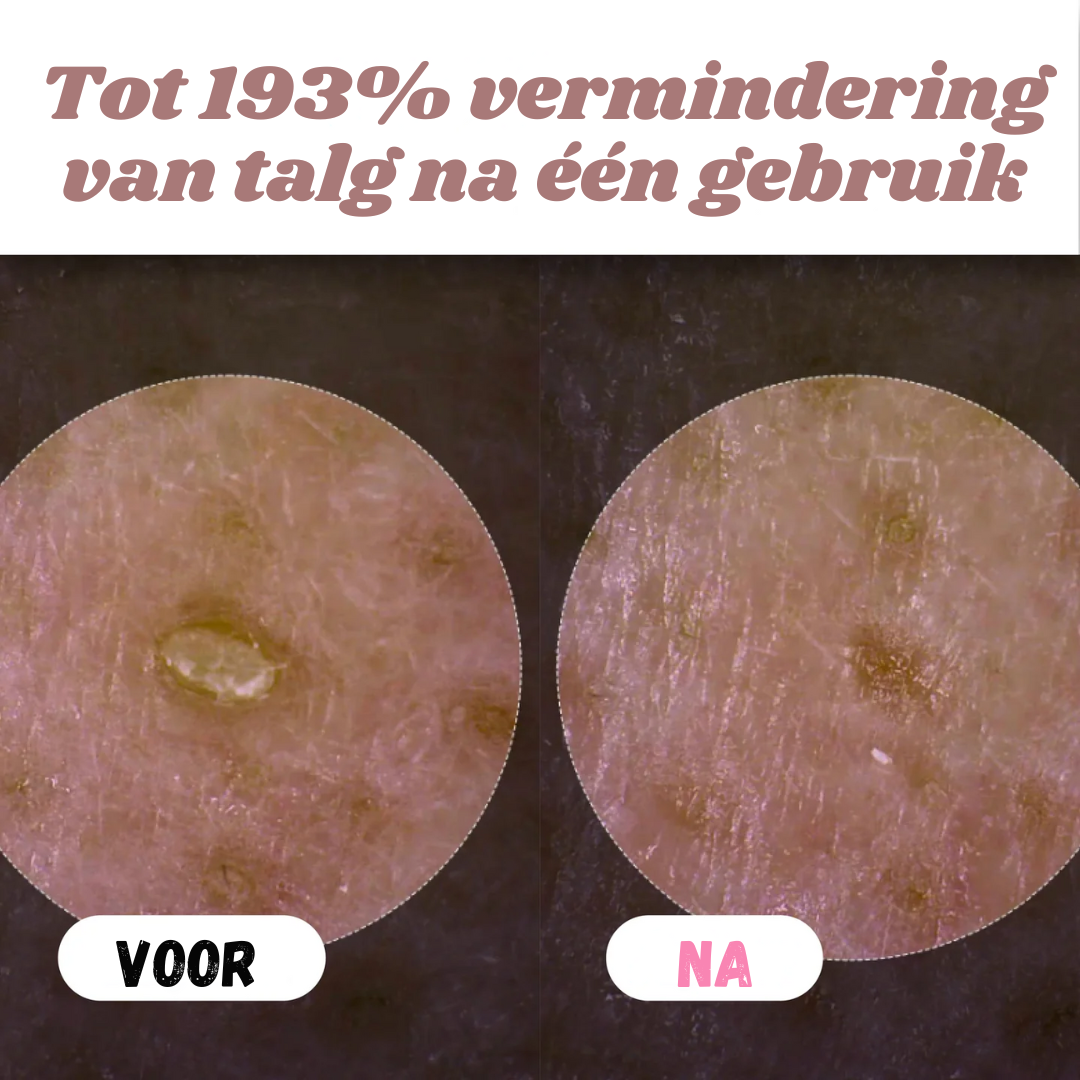 White & Black Rice Peel Shots – Verjongende Huidtransformatie