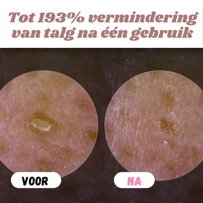 White & Black Rice Peel Shots – Verjongende Huidtransformatie