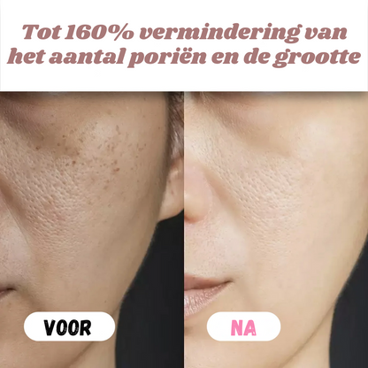White & Black Rice Peel Shots – Verjongende Huidtransformatie