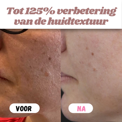 White & Black Rice Peel Shots – Verjongende Huidtransformatie