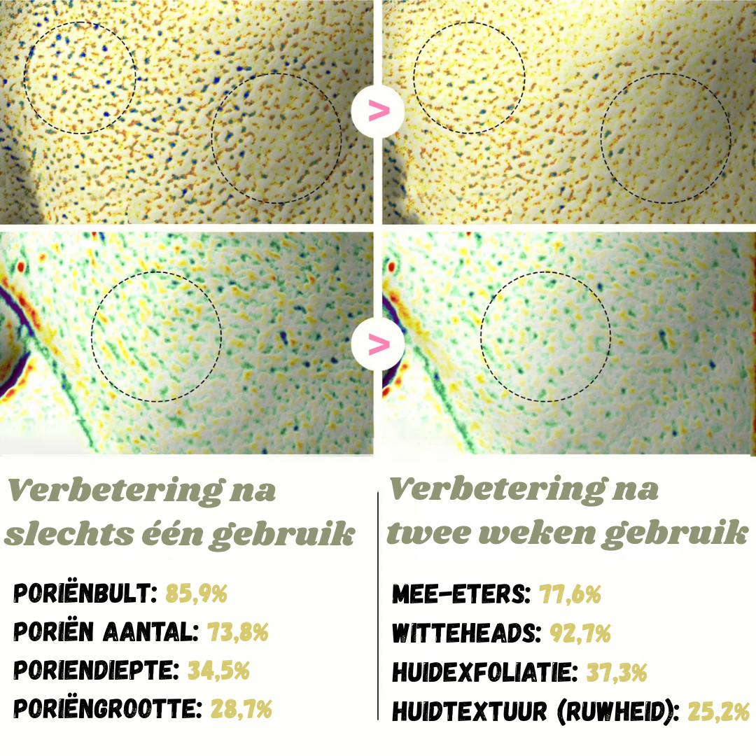 White & Black Rice Peel Shots – Verjongende Huidtransformatie