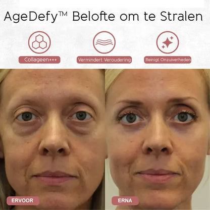 AgeDefy™ Trio Verjüngendes Hals- und Augenpflegeset mit Rotlichttherapie 